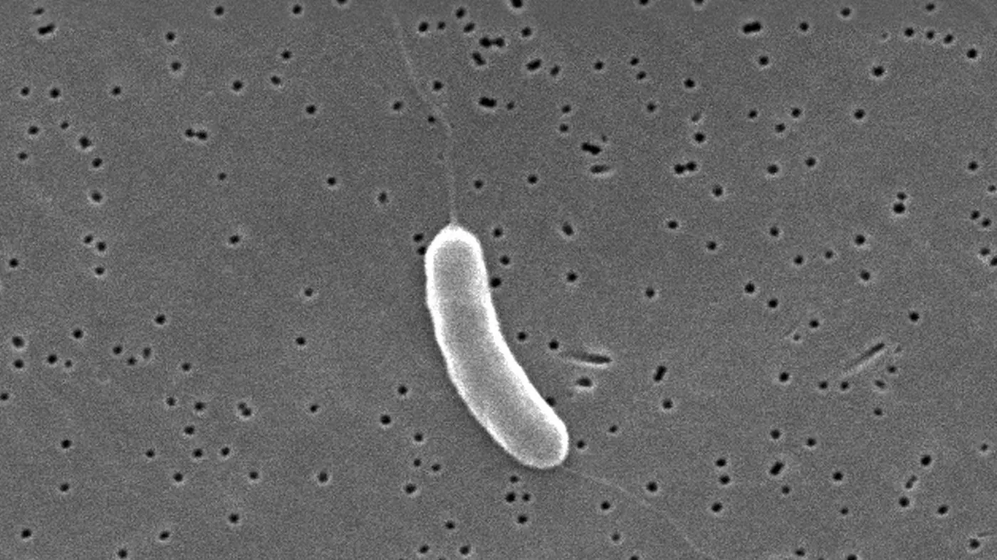 This electron microscope image provided by the Centers for Disease Control and Prevention shows a Vibrio vulnificus bacterium in 2005. (Janice Haney Carr/CDC via AP)
