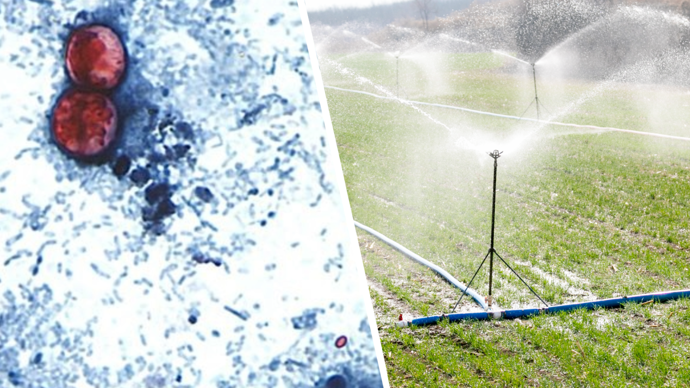 This undated photo taken through a microscope provided by the CDC shows Cyclospora cayetanensis oocysts, and an irrigation system in China.