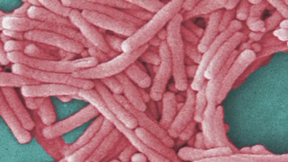Central Harlem Legionnaires’ outbreak results in seventh fatality (WPIX)