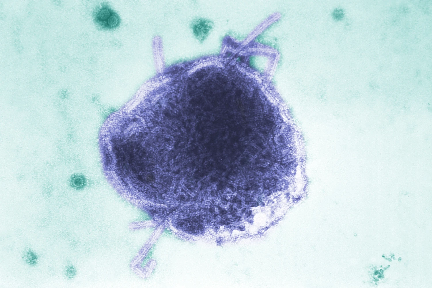 Measles virus.