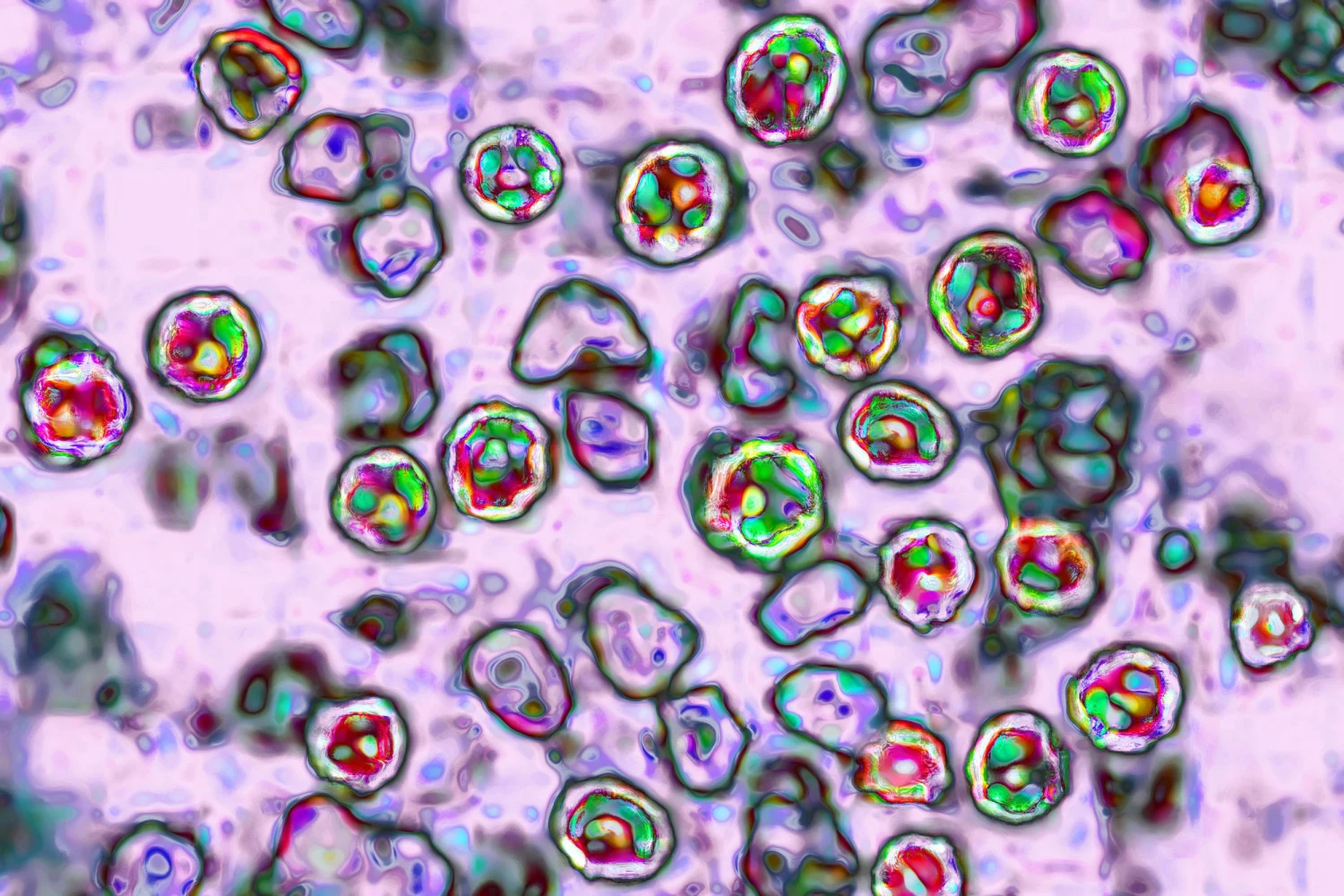 The measles virus under a microscope.