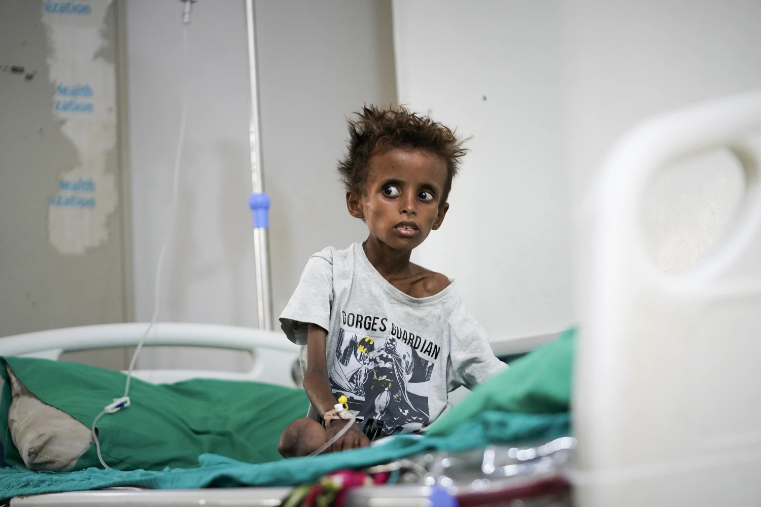 Tarek al-Salami, 7, who was displaced from the city of Mokha and is showing symptoms of malnutrition, sits on a bed while receiving treatment at a therapeutic feeding center in Buraiqa, on the western outskirts of Aden, Yemen, Tuesday, Sept. 22, 2026.