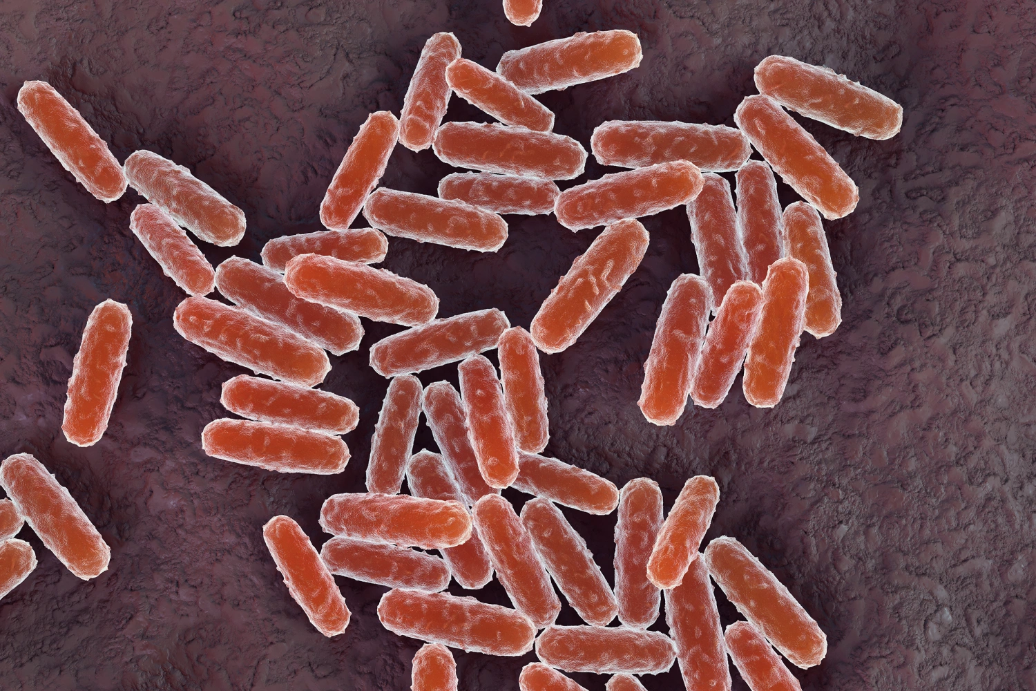 Plague is caused by the bacteria Yersinia pestis, and human plague remains endemic in some countries.