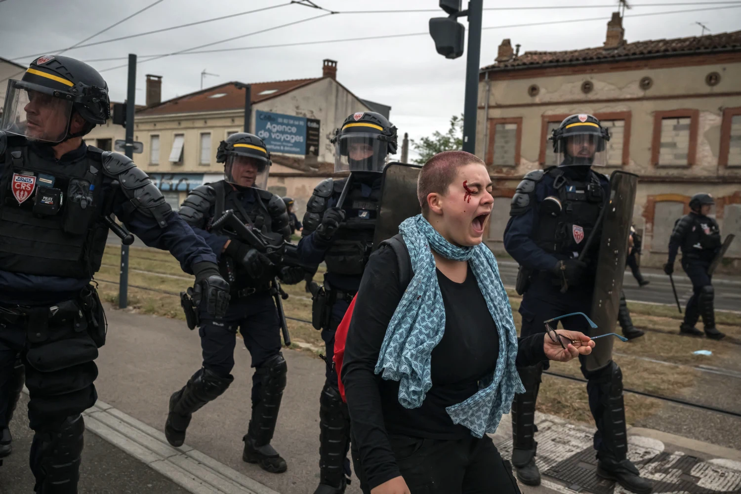 An injured protester and CRS riot police, near the Lycee Deodat high school in Toulouse, south-western France, on Oct. 1.