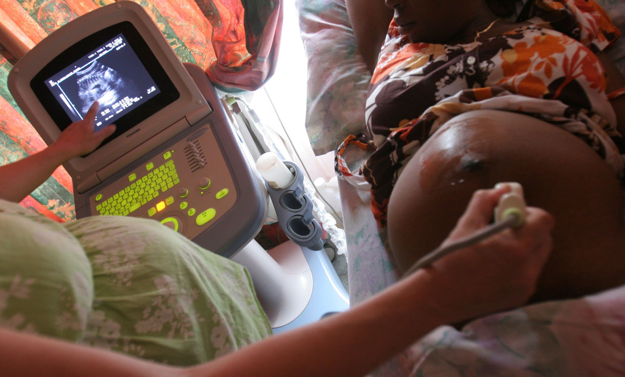 A sonar is performed on a pregnant woman at an AIDS care facility – partially funded by the President's Emergency Plan for AIDS Relief (PEPFAR) – in White River Junction, South Africa, in December 2008.